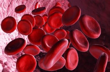 Anisocitose no Hemograma: Entenda a Diferença entre RDW-CV e RDW-SD com Simplicidade